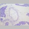 Pancreas SF 02.jpg